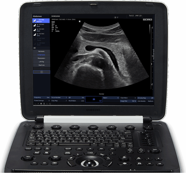 Ecógrafo Samsung HM70 EVO - Imagen 2